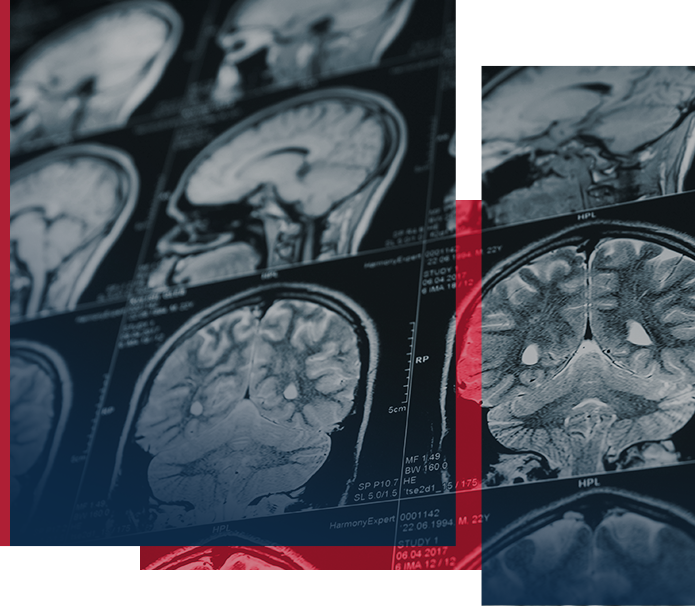 Brain Injuries
