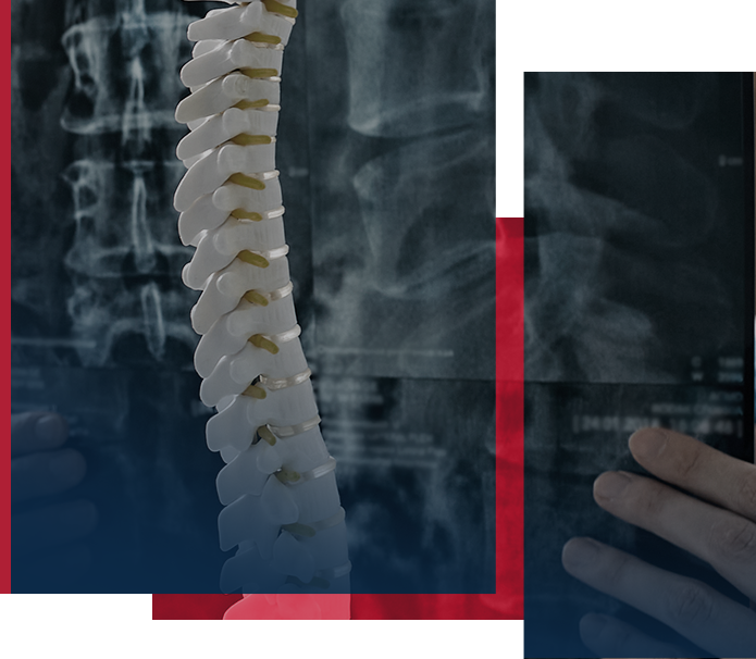Spinal Cord Injuries