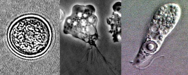 Is Mother Nature Solely Responsible for Brain Eating Amoeba Attacks?